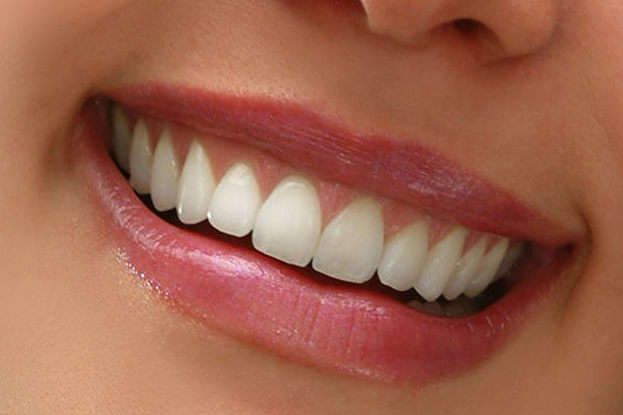 Second Opinion Dentist